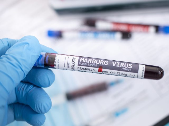 Blood samples with infected virus